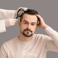 Haartransplantation in der Türkei vs. Ungarn – Preise pro Graft, DHI-Techniken und Gesamtpaket für europäische Männer